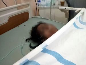 Diduga Keracunan Obat, Kulit Warga Sukabumi Ini Tiba-tiba Melepuh