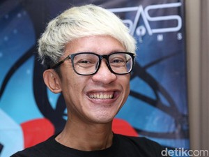 Nggak Bohong Nih! Muka Aming Memang Bonyok