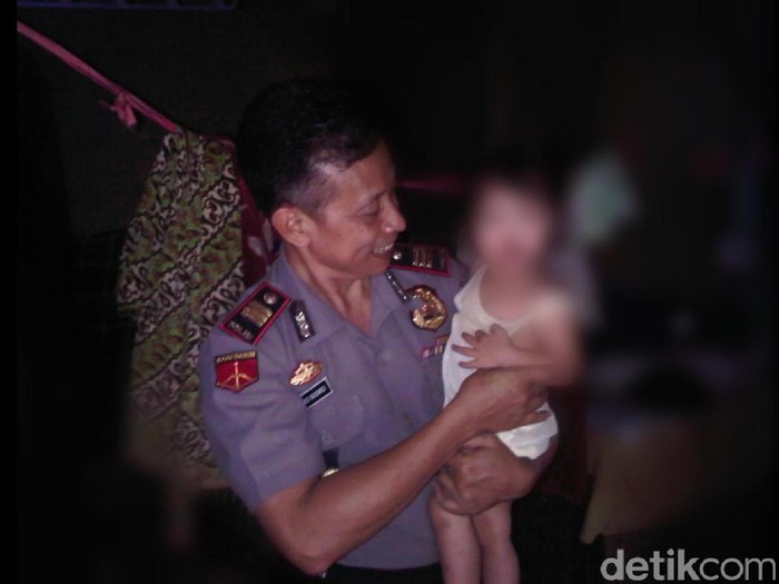 Cerita Kapolsek di Sukabumi yang Bantu Penyembuhan Balita Bibir Sumbing