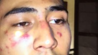 Axel Matthew menjadi sorotan karena babak belur usai dikeroyok oleh oknum polisi setelah diduga terkait narkoba. Dokumen Pribadi (Anak Jeremy Thomas)