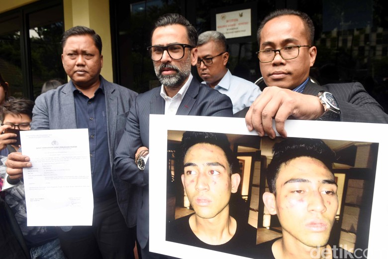 Polisi: Ada Bukti Transfer Anak Jeremy Thomas Beli Happy Five Polisi: Ada Bukti Transfer Anak Jeremy Thomas Beli Happy Five