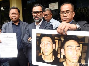 Bukti Axel Transfer Beli Happy Five, Jeremy Thomas Sebut Ada Konspirasi