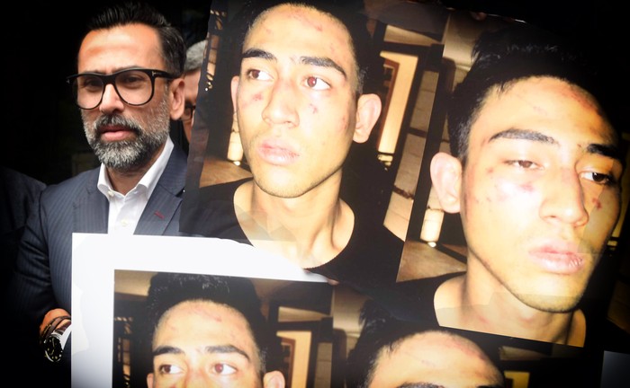 Anaknya Masih Diperiksa Polisi, Jeremy Thomas Kini Melunak