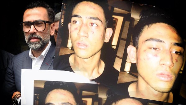 Putra Jeremy Thomas Babak Belur, Iqbaal CJR Jadi Dilan