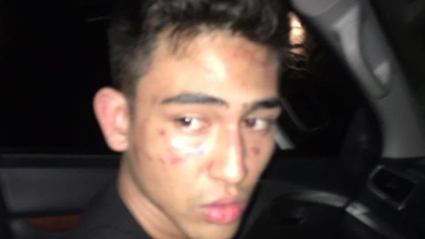 Anak Jeremy Thomas dikeroyok oknum polisi.