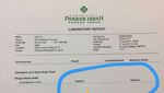 Axel Matthew Thomas Resmi Tersangka