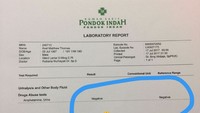 Meskipun Valerie Thomas sempat mengunggah hasil tes urine sang kakak yang dinyatakan negatif. (Dok. Instagram/valerieethomas)