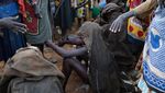 Foto: Tradisi Sunat Wanita di Pedalaman Afrika