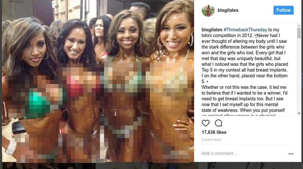 Postingan Cassey Ho di instagram soal implan payudara