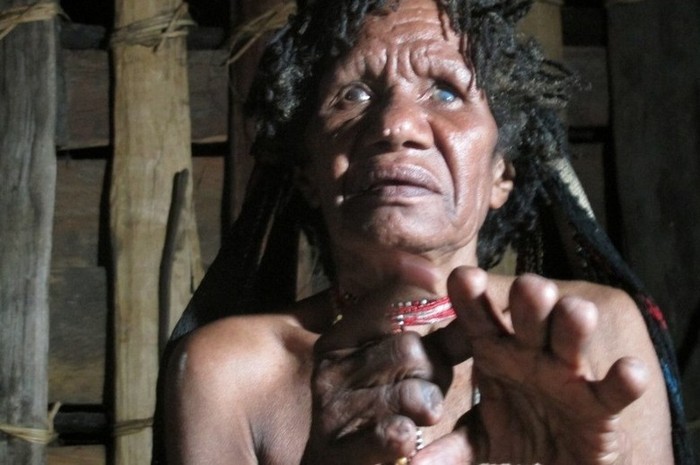 Cinta dan Potong Jari