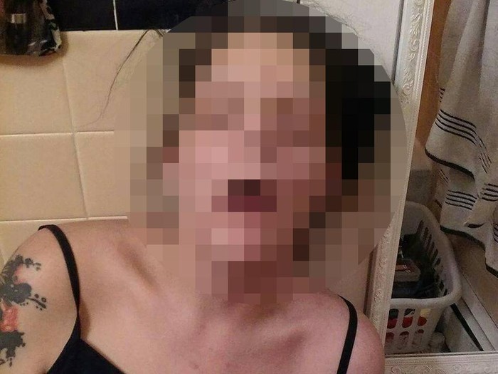 Melissa tidak ingin ada orang yang bernasib sama sepertinya. (Foto: Facebook/Melissa Lee Matos) Melissa tidak ingin ada orang yang bernasib sama sepertinya. (Foto: Facebook/Melissa Lee Matos)