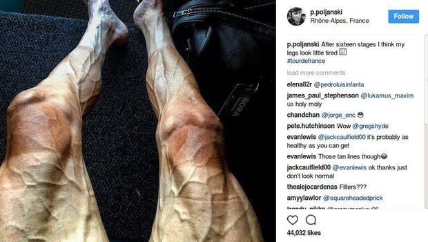 Keadaan kaki Pawel Poljanski setelah menyelesaikan tahap ke-16 Tour de France