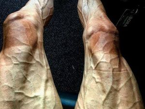 Pamer Paha Berurat usai Balapan, Pebalap Sepeda Ini Jadi Perbincangan