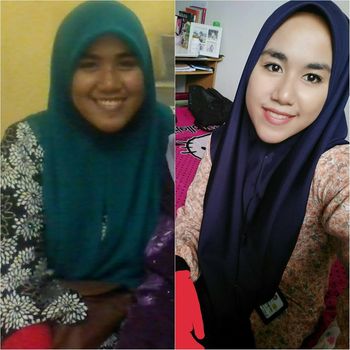 Pelajaran Berharga dari Gadis Cantik yang Dulu Disebut Badak & Ditolak Pria