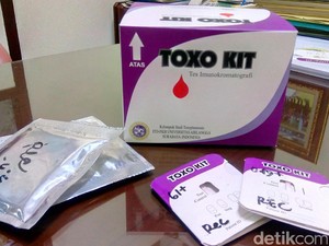 Sebentar Lagi Deteksi Tokso Jadi Semudah Tes Kehamilan