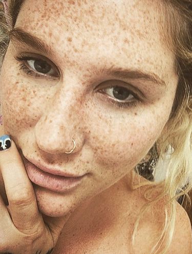 Mengejutkan, Ternyata Begini Wajah Asli Penyanyi Kesha Tanpa Makeup 