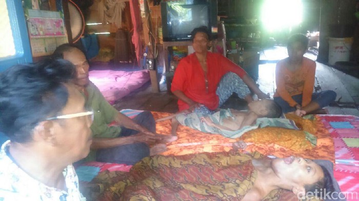 Tak Ikut Imunisasi, 2 Warga Ogan Komering Ilir Alami Lumpuh Layu