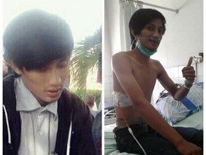 Curhat Seorang Istri yang Paru-paru Suaminya Harus Dibor Karena Rokok