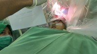 dr Irwan dan rekannya, dr Tedy Apriawan, SpBS tengah mengamati respons komunikasi dari pasien. Operasinya sendiri digelar di RSI Jemursari Surabaya pada hari Selasa (11/7) silam. Hanya dalam waktu 3 hari, pasien sudah diperbolehkan pulang. (Foto: Tim dr Irwan Barlian, SpBS (K)