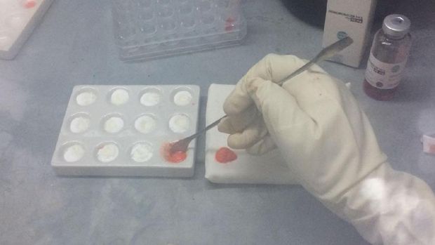 Koyo terapi kanker payudara bikinan mahasiswa UNAIR