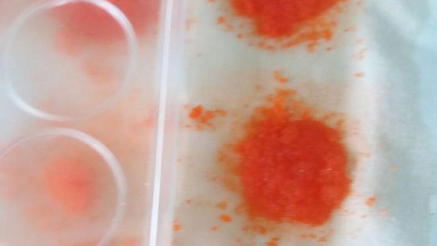 Koyo ini bekerja untuk menghambat penyebaran sel-sel kanker payudara