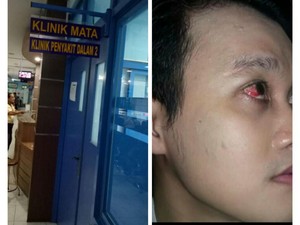 Korban Pemukulan Jadi Kapok Naik Grab