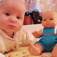 Duo botak dan bibir lucu. Foto: Istimewa