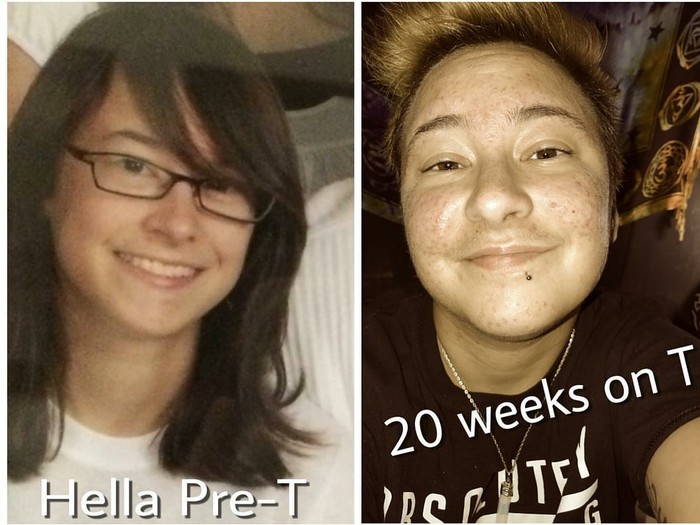 Erimning sevgilisini emizaman Tranny qizlarning anusidan litrli sperma: kompilyatsiya