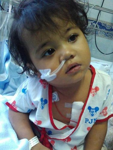 Batita ini mengalami jantung bocor sejak lahir dan butuh biaya pengobatan.