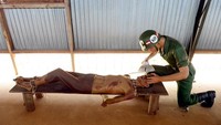 Siksaan lainnya adalah membuat para tahaan buta. Tahanan akan diikat terbaring di atas kursi panjang. Kemudian penjaga akan menggunakan lampu yang berintesitas tinggi yang diarahkan langsung ke mata tahanan (phuquocprison.org)