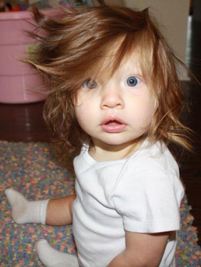 Satu lagi bayi berambut gondrong dengan ekspresi menggemaskan. Foto ini diambil ketika ia berusia 10 bulan.  Foto: Ist.