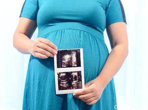 Kisah Ibu Hamil Secara Alami Saat Jalani Program Bayi Tabung