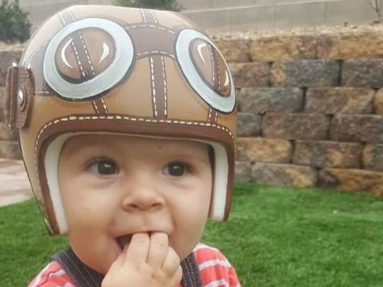 Foto Imutnya Para Bayi Pakai Helm Karena Bentuk Kepala Tak Rata