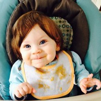 Bayi yang satu ini lahir dengan rambut lebat. Uniknya rambut bayi ini seperti wig tampak tidak tumbuh dari kepalanya. Foto: Ist.