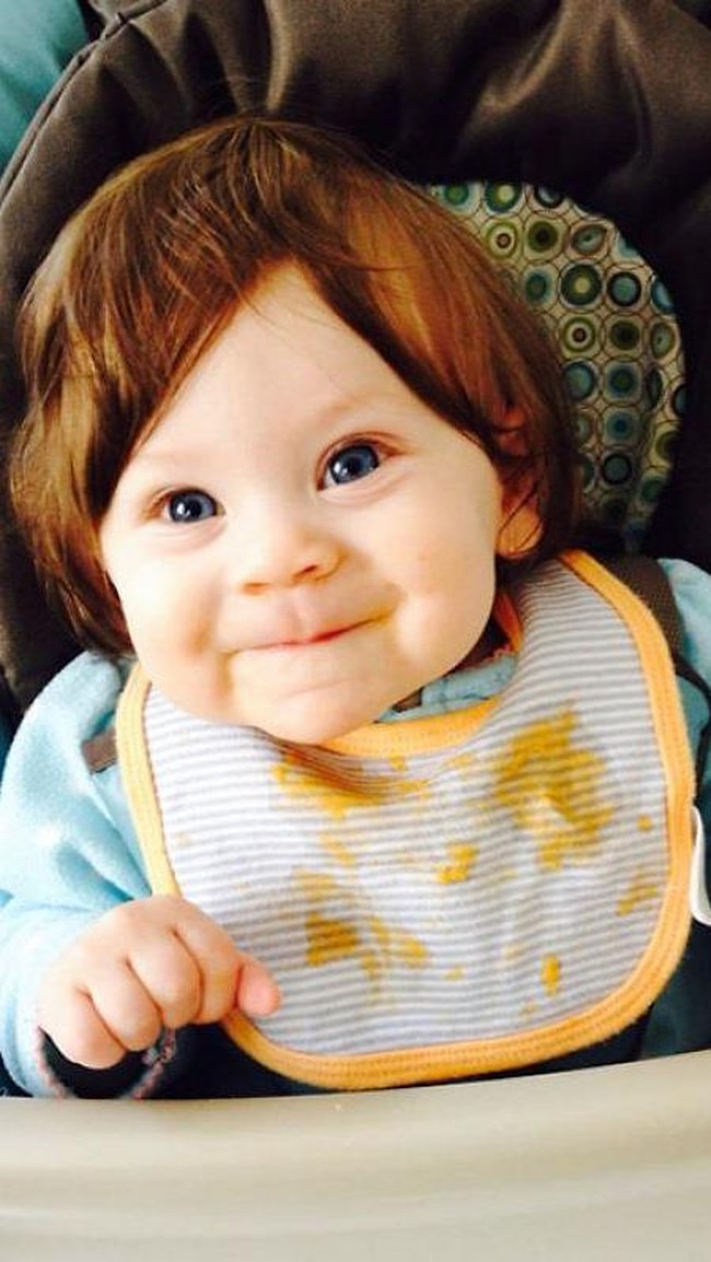 Bayi yang satu ini lahir dengan rambut lebat. Uniknya rambut bayi ini seperti wig tampak tidak tumbuh dari kepalanya. Foto: Ist.