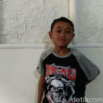 Dwi Josi tak punya anus dan alat kelamin/