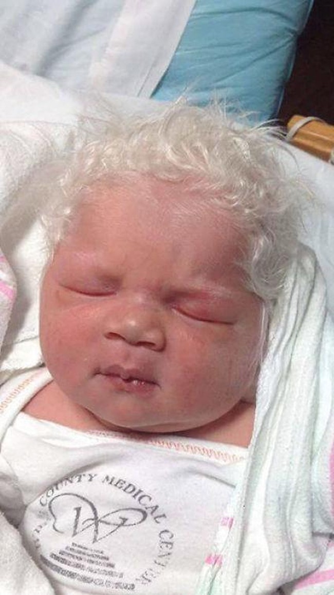 Ini merupakan gaya rambut bayi terputih yang pernah ada. Lihat rambutnya seperti kapas.  Foto: Ist.