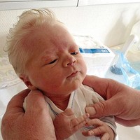 Bayi asal Norwegia ini terlahir dengan rambut putih dan tipis seperti lansia. Lucunya! Foto: Ist.
