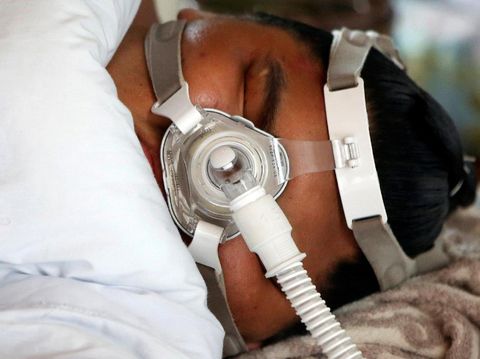 Sungkup atau masker CPAP digunakan untuk mengatasi penyempitan pada saluran napas saat tidur. Kondisi yang disebut sleep apnea tersebut antara lain ditandai dengan sering ngorok atau mendengkur.