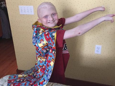 Bukan di Bibir, Bocah Ini Alami 'Sumbing' di Hampir Sekujur Tubuhnya