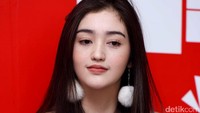 Pesinetron berusia 18 tahun itu yakin setelahnya Ammar akan menjadi lebih baik. Pool/Noel/detikFoto.