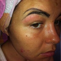 Alis wanita terbagi dua. Wanita ini syok dengan bentuk alisnya tersebut, hasil dari tato alis yang gagal.Foto: ist