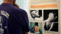 Seorang warga nampak terpaku pada poster dengan gambar sejumlah korban ledakan Nagasaki yang menderita luka serius. (Istimewa).
