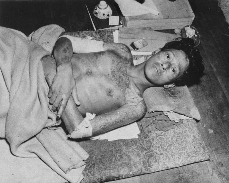 CHICAGO - AUGUST 03:  Josh Nelson looks at an informational panel describing the aftereffects of the A-Bomb at an exhibit titled 