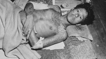 Oppenheimer pernah membela diri bahwa Manhattan Project merupakan sesuatu yang penting. Akan tetapi seiring waktu, ia tampaknya menyesal. Pada bulan Oktober 1945, Oppenheimer mengunjungi Presiden Harry S Truman, dan kabarnya memberitahunya, “Mr. Presiden, saya memiliki darah di tangan saya. Di masa selanjutnya, ia banyak mengkampanyekan bahaya bom nuklir. Foto: Istimewa