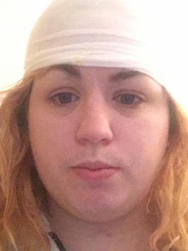 Mengerikan! Coba-coba Cat Rambut Sendiri di Rumah, Wanita Ini Malah Botak