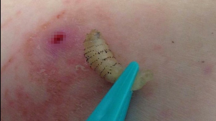 infeksi oleh parasit larva lalat bot
