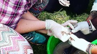 Di daerah Afrika parasit belatung botfly biasanya bersarang di kaki. Ini karena masyarakat setempat jarang memakai alas kaki. (Foto: Instagram/kailnsw)