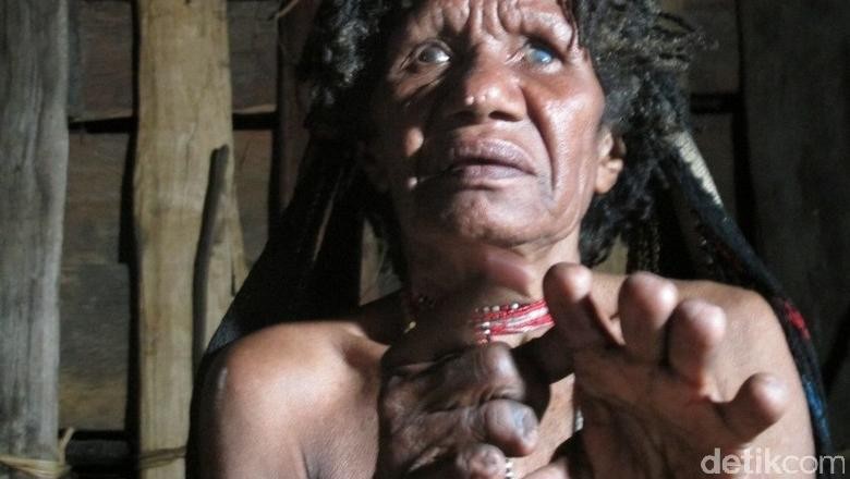 Wanita Suku Dani yang masih menerapkan tradisi potong jari (Afif/detikTravel) Wanita Suku Dani yang masih menerapkan tradisi potong jari (Afif/detikTravel)