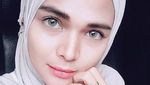 Cantiknya Istri yang Ditalak Enji eks Ayu Ting Ting, Transformasi Ello